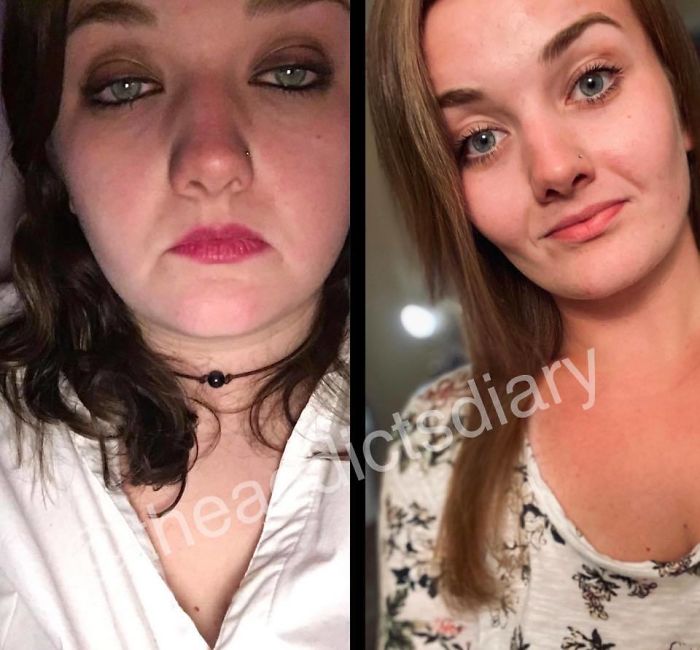 Trasformation-Stories-Before-After-The-Addicts-Diary