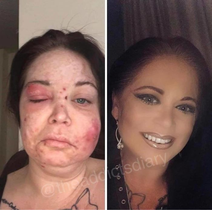 Trasformation-Stories-Before-After-The-Addicts-Diary