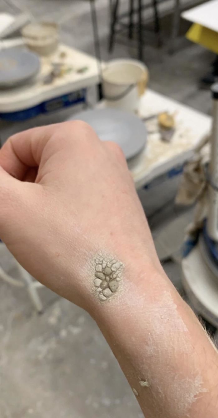 This Clay On My Hand Makes It Look Like I Have Grayscale