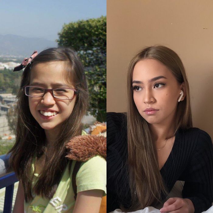 Age 10 - 18! Thank God For Braces (My Teeth R Straight Now, I Swear)