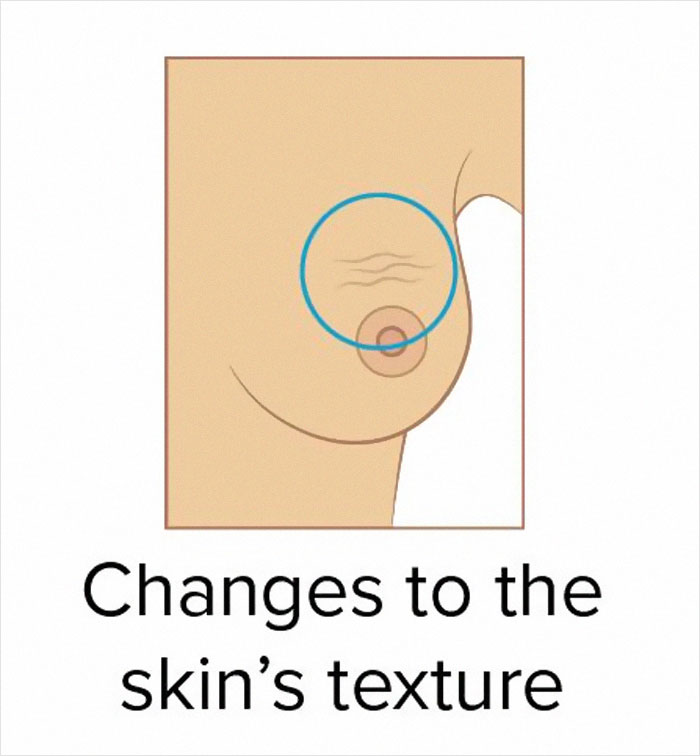 These 9 Pictures Show The Most Common Signs Of Breast Cancer These 9 Pictures Show The Most Common Signs Of Breast Cancer