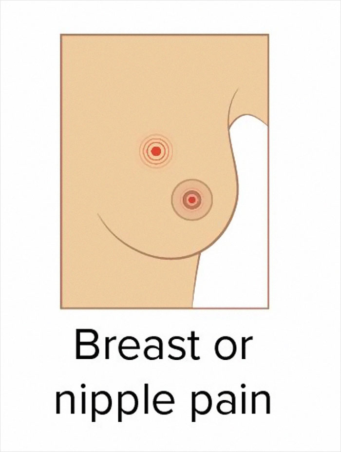 These 9 Pictures Show The Most Common Signs Of Breast Cancer These 9 Pictures Show The Most Common Signs Of Breast Cancer