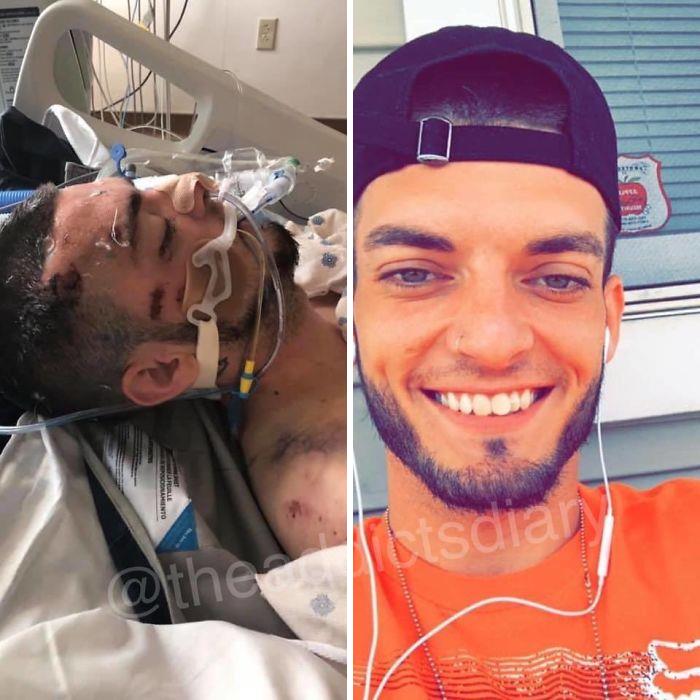 Trasformation-Stories-Before-After-The-Addicts-Diary