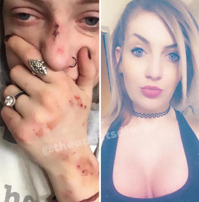 Trasformation-Stories-Before-After-The-Addicts-Diary