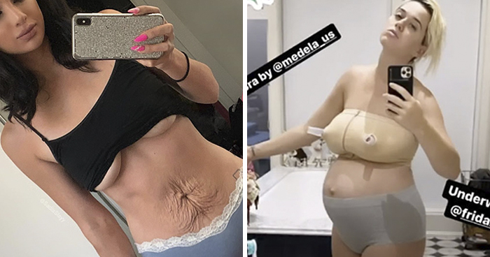 30 Celebs Who Didn’t Hide Their Postpartum Bodies To Maintain An Unrealistic Body Image