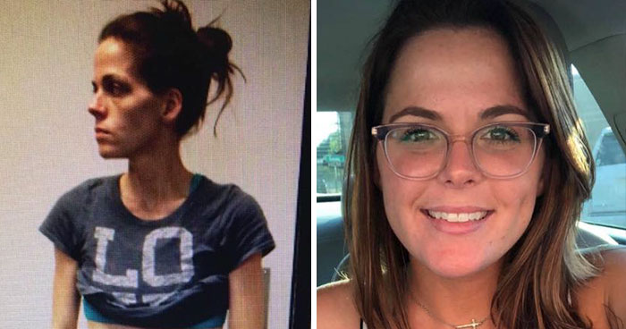 ‘The Addict’s Diary’ Showcases Before & After Transformations Of People Who Quit Drugs (30 New Stories)