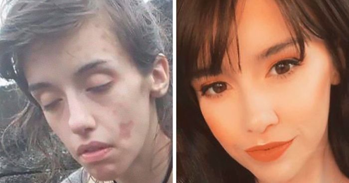 ‘The Addict’s Diary’ Showcases Before & After Transformations Of People Who Quit Drugs (30 New Stories)