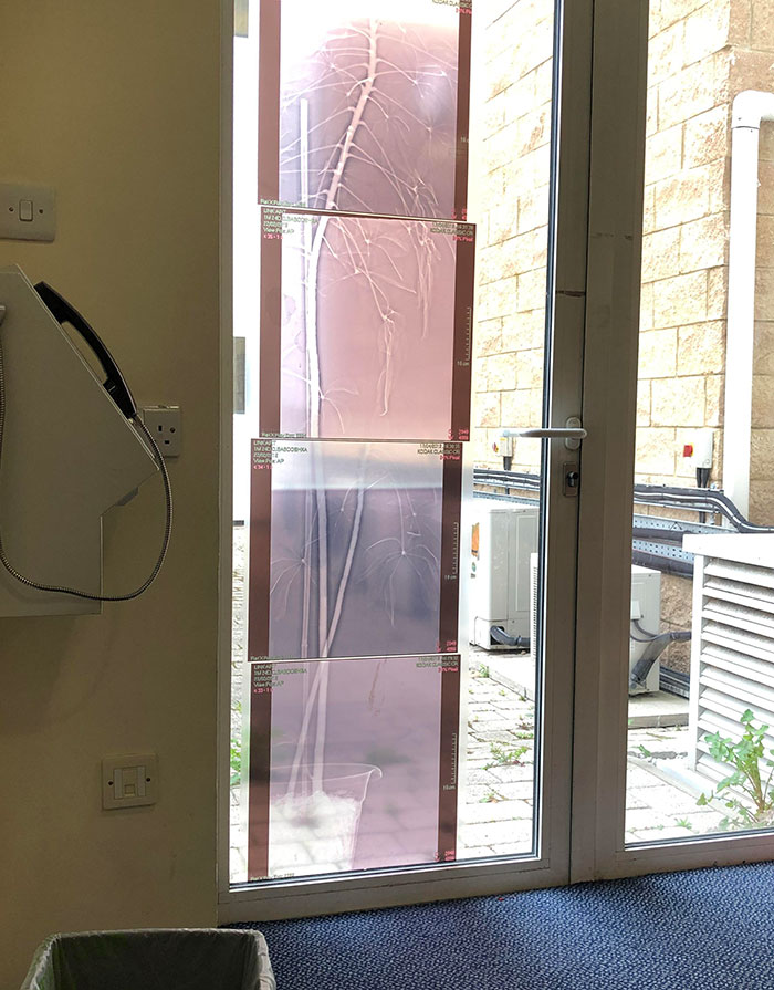 X-Ray Of A Plant As A Decoration At My Local Hospital