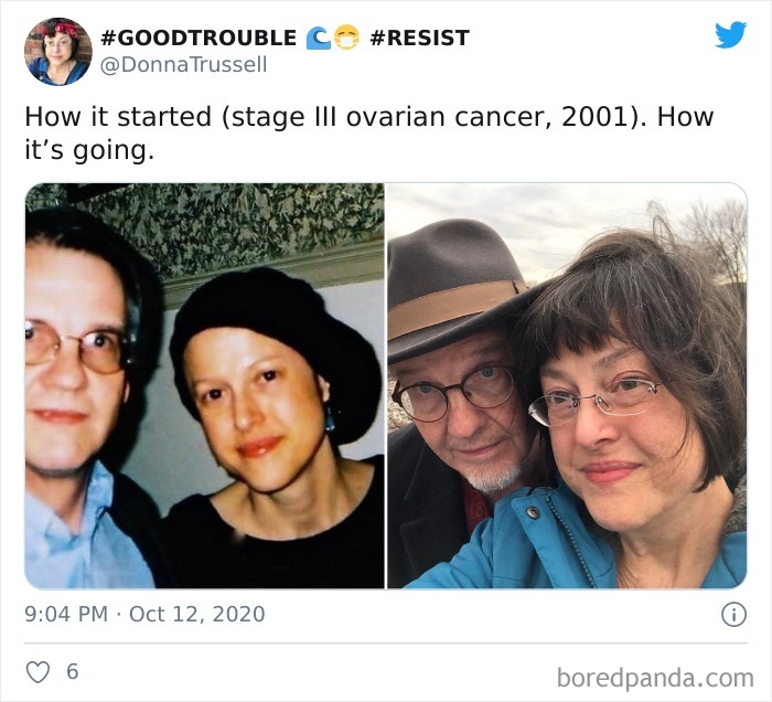 Side-by-side photos showing a woman’s cancer journey from diagnosis to thriving years later, highlighting cancer stories challenge.