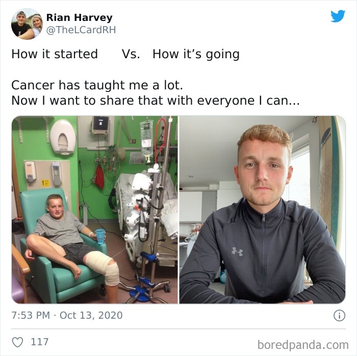 Before and after photos of a young man showing his cancer journey as part of a wholesome cancer stories challenge.