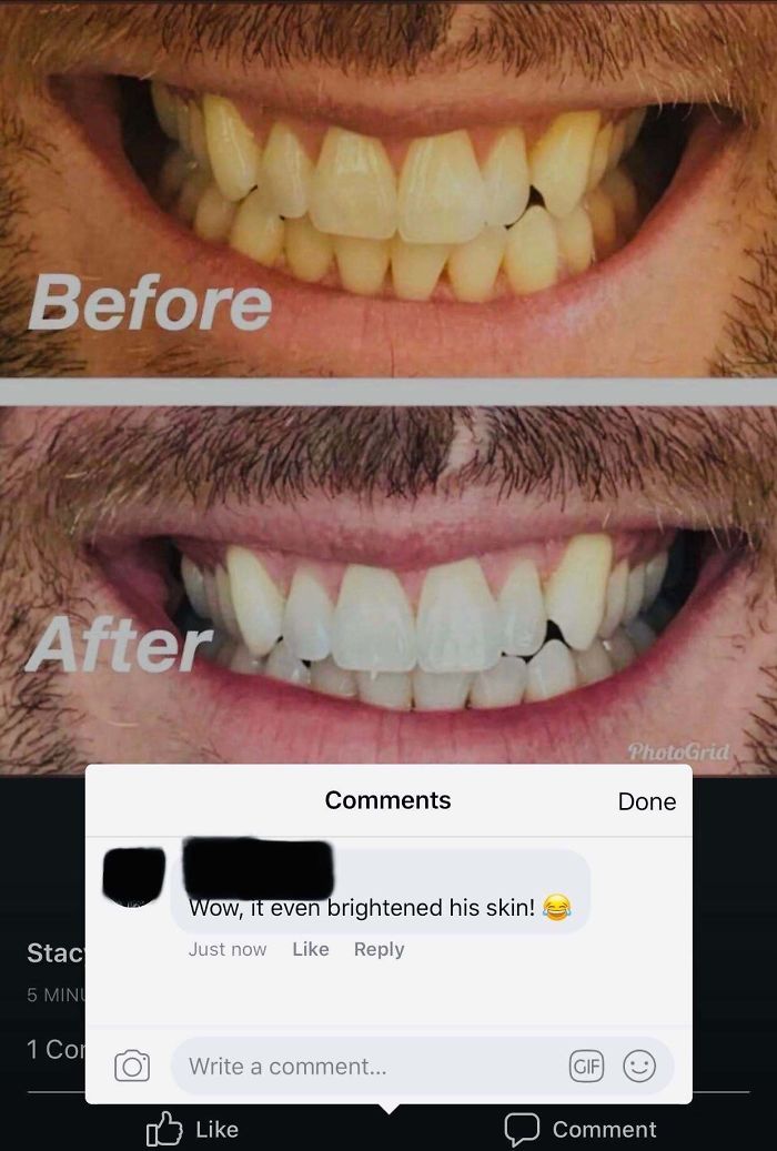 Whiter Teeth