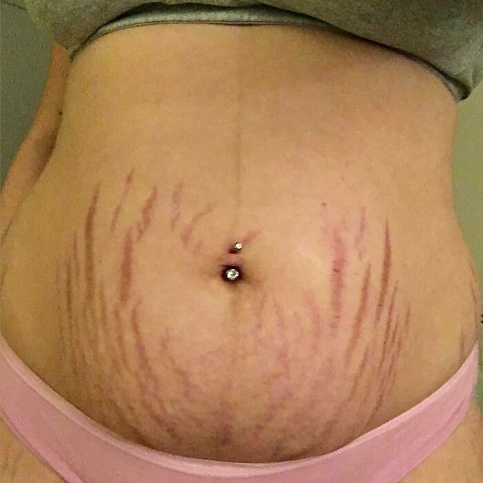 "I've Never Felt So Good In My Own Skin Before Now"