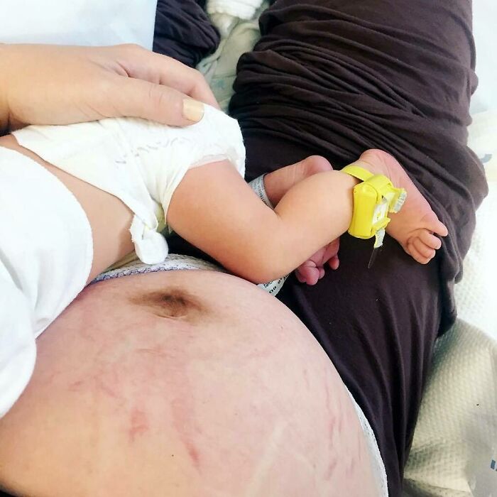 "Nothing But Sheer Amazement, Thinking About How That Little Body Fit Inside This Stomach, Just Two Days Ago"