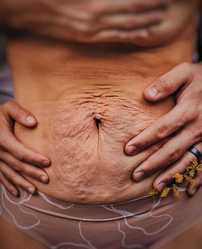 Postpartum Is Framed In Terms Of Losing Baby Weight And ‘Bouncing Back.’