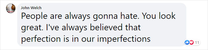 Trolls Verbally Attack This Athlete And Bodyshame Her, She Responds With Swimsuit Pics