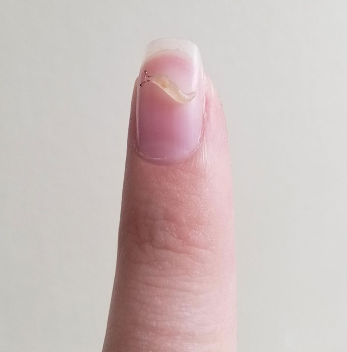 Just Hatched Today. Welcome To The World Little Slug Buddy And Siblings