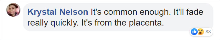 A Puppy With Green Fur Was Born In Italy And The Owners Named Him Pistachio A Puppy With Green Fur Was Born In Italy And The Owners Named Him Pistachio