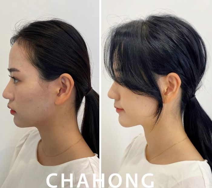 Hair-Transformations-Jung-Eunhye