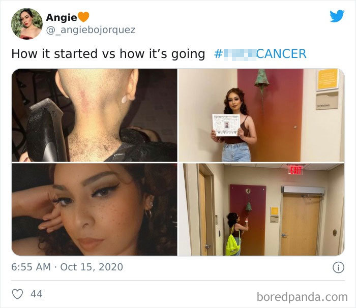 Woman sharing her cancer journey with before and after photos, celebrating recovery and hope in a wholesome challenge post.