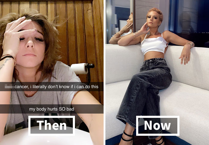 People Take ‘How It Started Vs. How It’s Going’ Challenge To Another Level Of Wholesomeness By Sharing Their Cancer Stories (30 Pics)