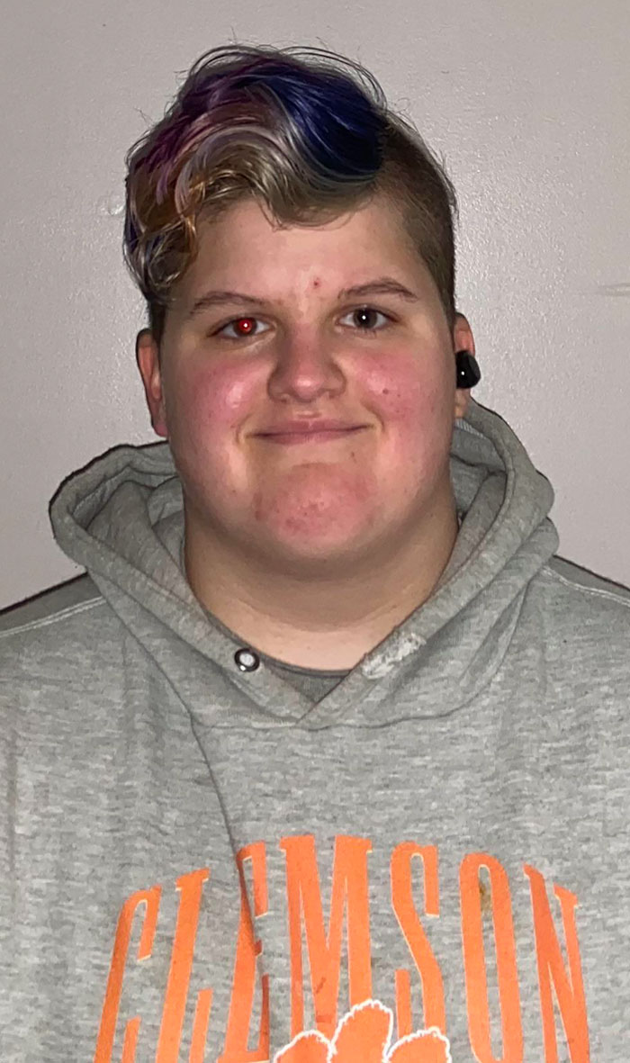 What Happens If I Take A Photo Of My Left Eye, Which Is Partially Blind