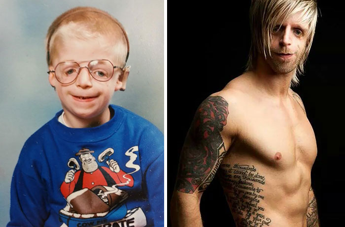 Jono Lancaster Was Given Up For Adoption Because Of His Birth Defect And Now He’s A Professional Model, A Teacher And An Inspiration To Millions!