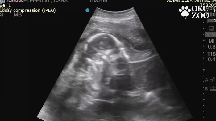 Zoo Shares An Ultrasound Of A Baby Elephant And People Find It Adorable