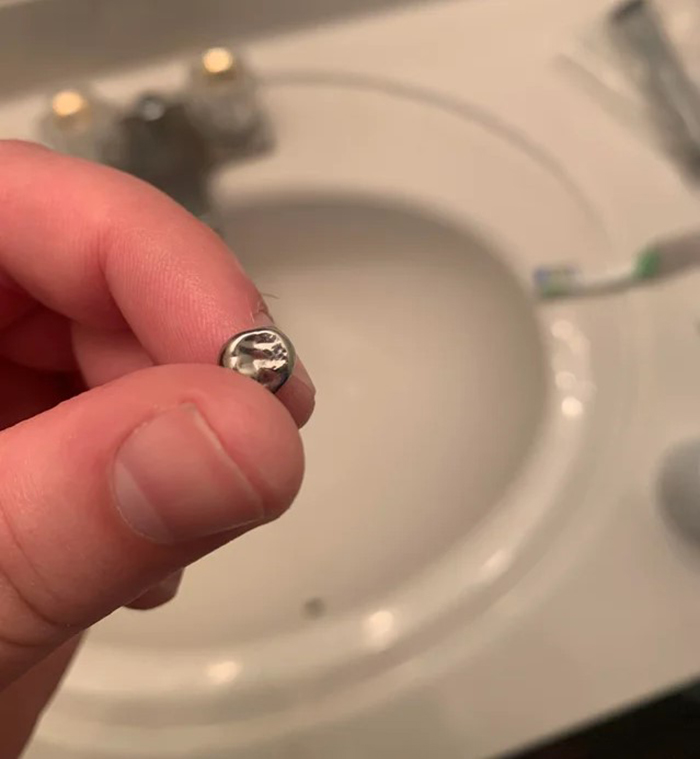 Found Someone’s Tooth In My Apartment Complex Laundry