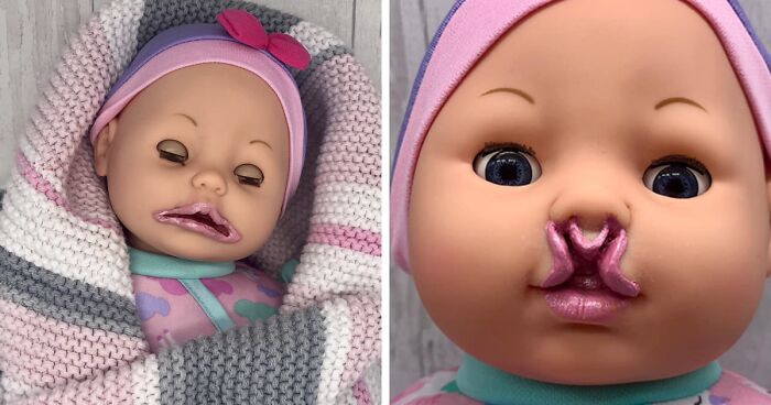 Mom Creates Dolls With Disabilities To Help Kids Feel Accepted (28 Pics)Mom Creates Dolls With Disabilities To Help Kids Feel Accepted (28 Pics)
