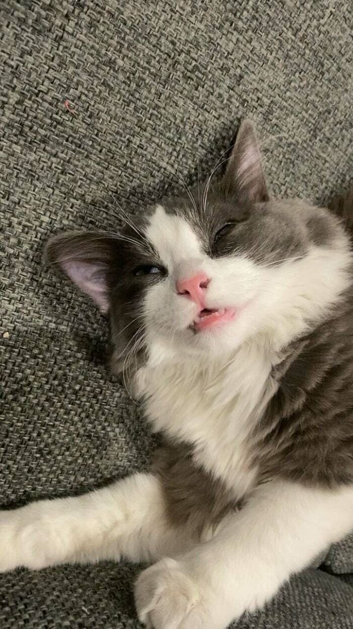 Yes, He’s Sleeping. No, He Isn’t Sedated