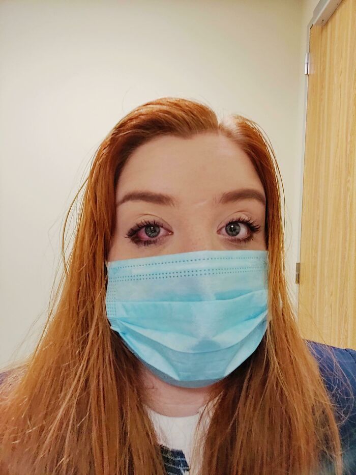 Got Something In My Eye Seconds Before My Interview. Enjoyed Crying Out Of One Eye During The Interview