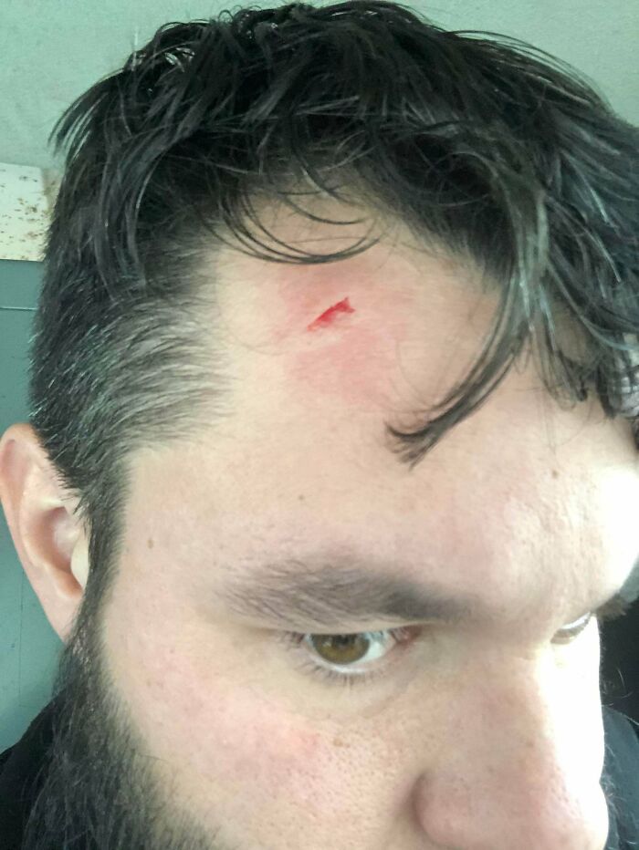 Door Frames Get You Once, But Ceiling Fans Get You More Than Once...yeah, Walked Into A Ceiling Fan.