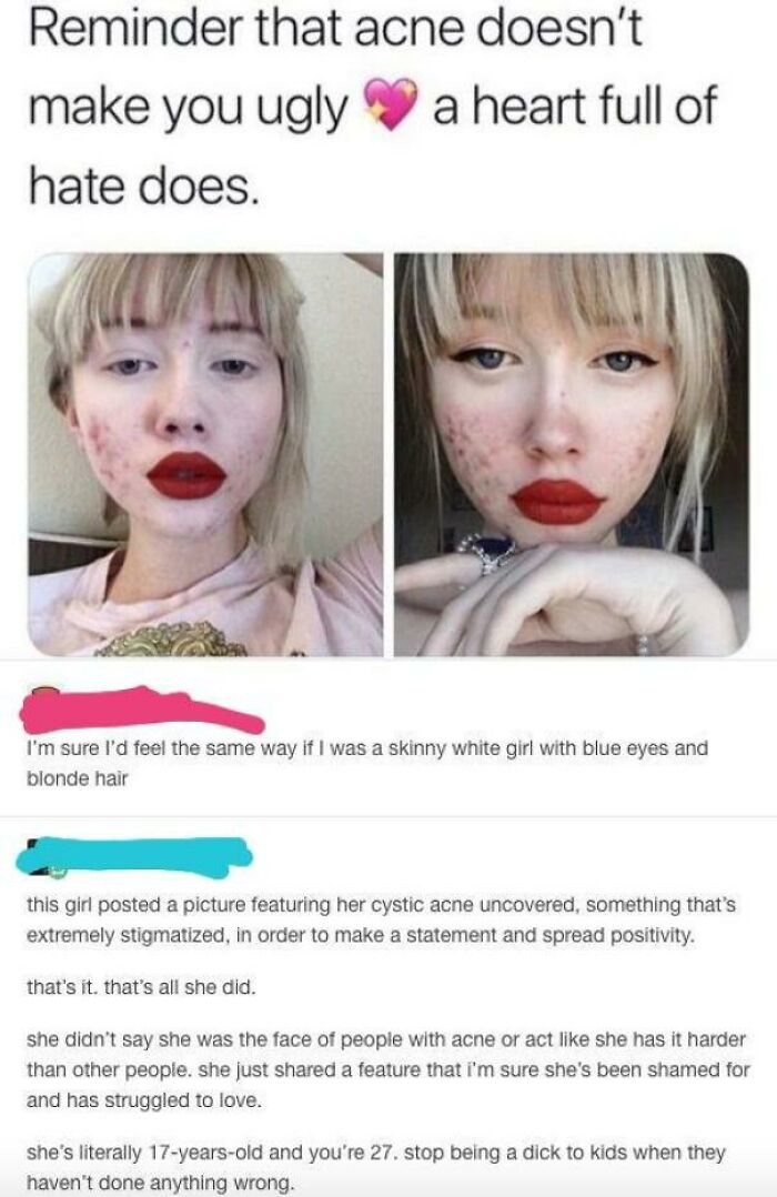 To Bash A Girl With Acne