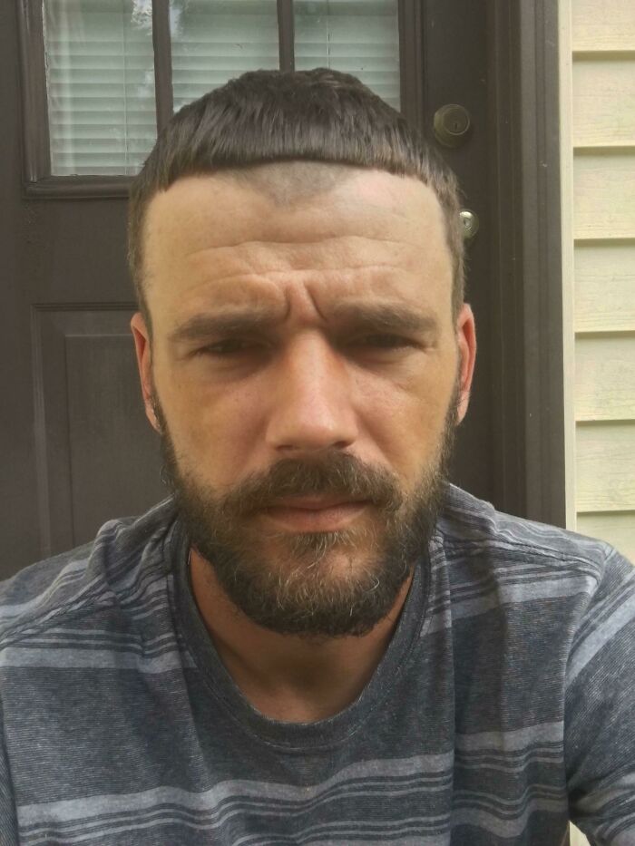 I Asked To Have It Edged Up So My Bangs Would Be Straight. Proceeded To Cut All My Bangs Off And My Entire Widows Peak. White Guy At A Black Barbershop Problems