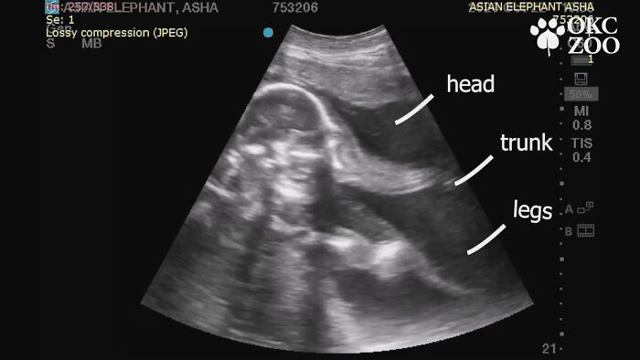 Zoo Shares An Ultrasound Of A Baby Elephant And People Find It Adorable