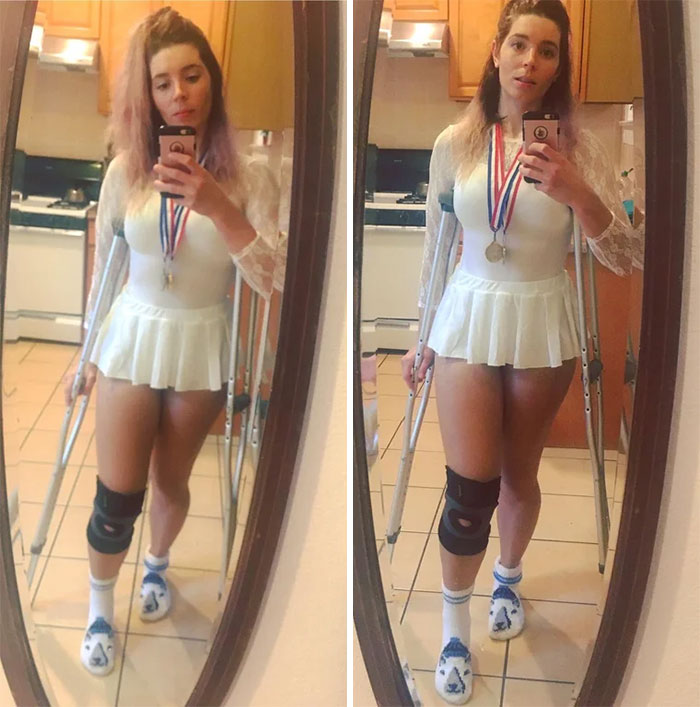 Had Hip Surgery On Wednesday So Great Timing For A Nancy Kerrigan Costume