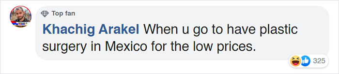 Somebody Pulled A 'Not My Job' On This 1923 Statue During Its Restoration Somebody Pulled A 'Not My Job' On This 1923 Statue During Its Restoration
