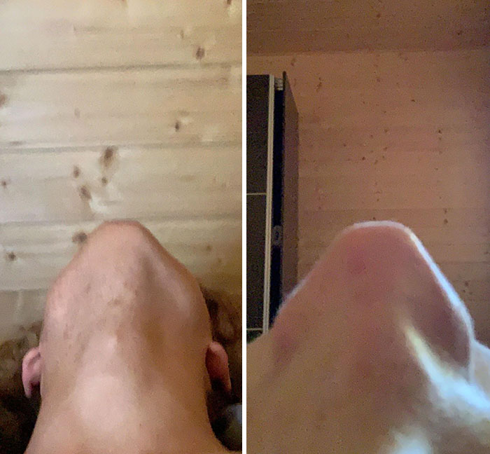 My Jaw From Below Looks Like My Nose From Above