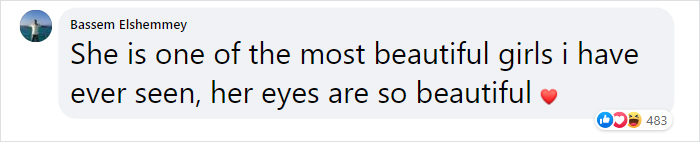 "I'm Weird-Looking": Anya Taylor-Joy Of 'The Queen's Gambit' Says She's Not Beautiful Enough To Be In Films "I'm Weird-Looking": Anya Taylor-Joy Of 'The Queen's Gambit' Says She's Not Beautiful Enough To Be In Films