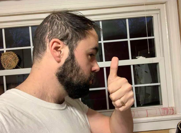 Today Is Close To 8 Months Since My 12th Brain Surgery. I’m Happy To Still Be Alive And Thriving