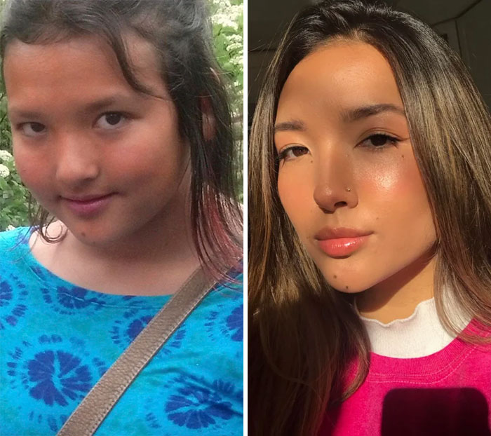 Just Puberty. 12 To 18