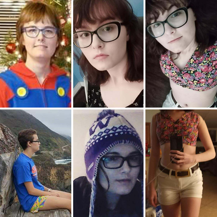 17/18 Versus 20. I Got Told I Was Ugly A Lot When I Was Younger... Comments Seem To Have Changed, So... I Hope I Qualify