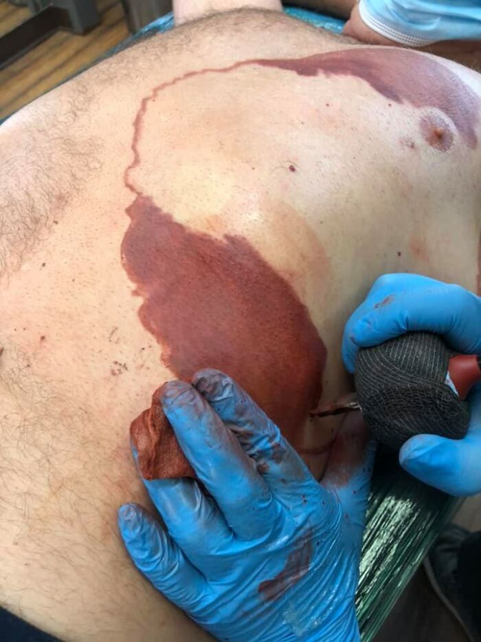 Tattoo artist creating an identical tattoo to mimic a birthmark on a dad's back. Tattoo artist creating an identical tattoo to mimic a birthmark on a dad's back.