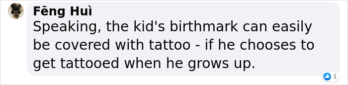 Comment discussing covering a child's birthmark with a tattoo in the future. Comment discussing covering a child's birthmark with a tattoo in the future.
