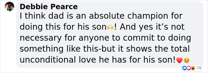 Social media comment praising dad for getting a tattoo identical to his son's birthmark out of love. Social media comment praising dad for getting a tattoo identical to his son's birthmark out of love.