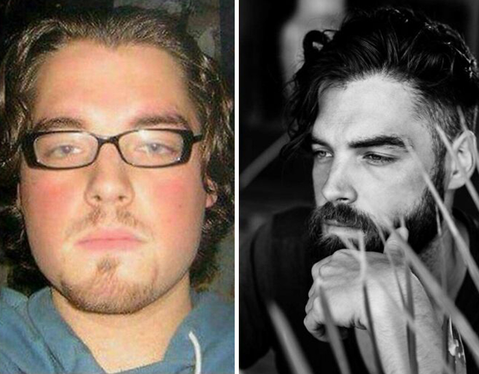 Lost Weight, Grew A Beard And Started Doing Modeling In My 30s. Not Much Success But Is Nice To Be Skinny And Relatively Fit