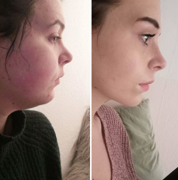 82lbs Lost. Perseverance Is Worth It