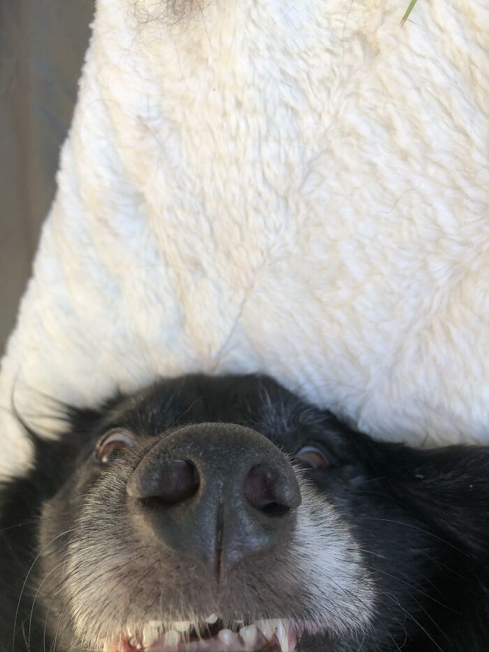 “What Do You Mean My Teeth Are Crooked?”