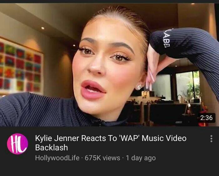 Y’all Have Made Me Notice Hairlines More