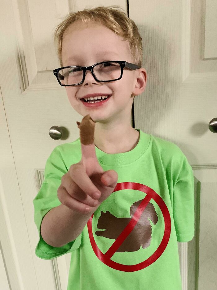 My Son Cornered And Tried To Pet An Injured Squirrel. Didn’t Go Well